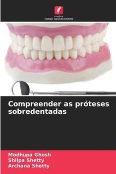 Paperback Compreender as próteses sobredentadas [Portuguese] Book