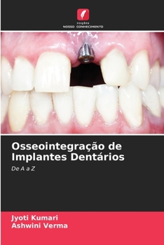 Paperback Osseointegração de Implantes Dentários [Portuguese] Book