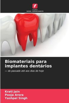 Biomateriais para implantes dentários (Portuguese Edition)