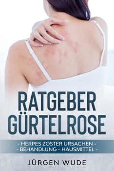 Paperback Ratgeber Gürtelrose: Herpes Zoster Ursachen Behandlung Hausmittel [German] Book