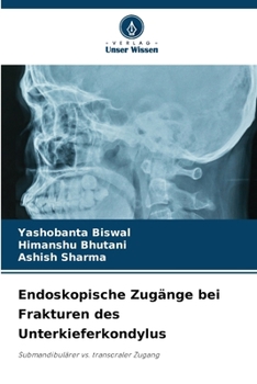 Paperback Endoskopische Zugänge bei Frakturen des Unterkieferkondylus [German] Book