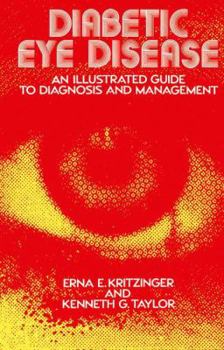 Hardcover Diabetic Eye Disease: An Illustrated Guide to Diagnosis and Management Book