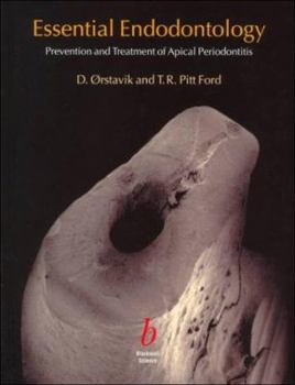 Hardcover Essential Endodontology: Prevention and Treatment of Apical Periodontitis Book