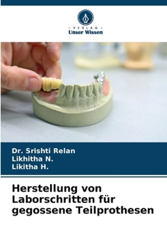 Herstellung von Laborschritten für gegossene Teilprothesen (German Edition)