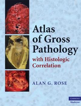 Hardcover Atlas of Gross Pathology: With Histologic Correlation Book