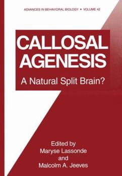Hardcover Callosal Agenesis: A Natural Split Brain Book
