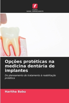 Paperback Opções protéticas na medicina dentária de implantes [Portuguese] Book