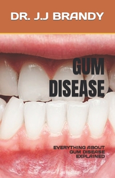 Paperback Gum Disease: Everything about Gum Disease Explained Book