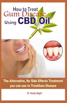 Paperback How to Treat Gum Disease Using CBD oil: The Alternative No Side Effects Treatment you can use to Treat Gum Disease Book