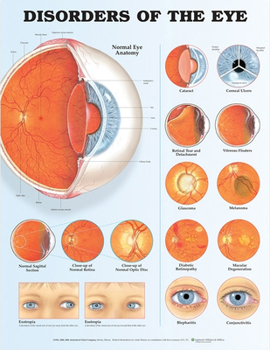 Wall Chart Disorders of the Eye Anatomical Chart Book