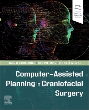 Paperback Computer-Assisted Planning in Craniofacial Surgery Book