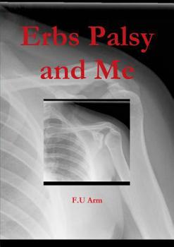 Paperback Erbs Palsy and Me Book
