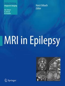 Paperback MRI in Epilepsy Book