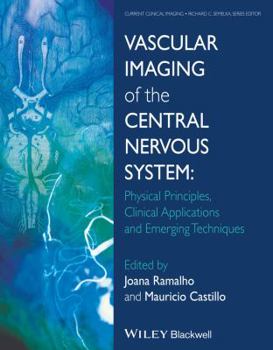 Hardcover Vascular Imaging of the Central Nervous System: Physical Principles, Clinical Applications, and Emerging Techniques Book