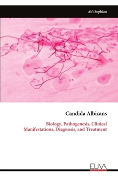 Candida Albicans: Biology, Pathogenesis, Clinical Manifestations, Diagnosis, and Treatment