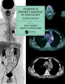 Hardcover Husband & Reznek's Imaging in Oncology Book