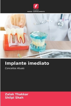 Paperback Implante imediato [Portuguese] Book
