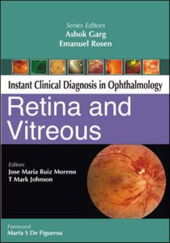 Paperback Retina and Vitreous Book