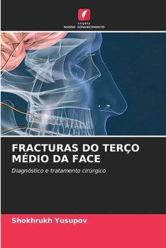 Paperback Fracturas Do Terço Médio Da Face [Portuguese] Book