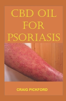 PSORIASIS AND CBD OIL: All You Need to Know on how to use CBD oil to treat Your Psoriasis