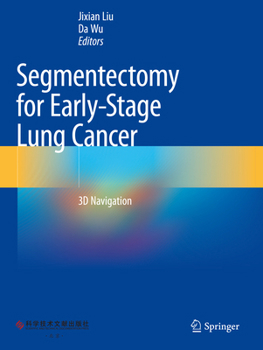 Paperback Segmentectomy for Early-Stage Lung Cancer: 3D Navigation Book