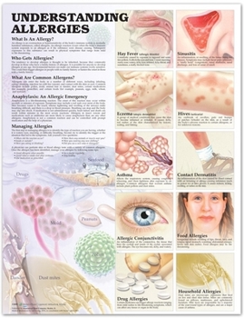 Understanding Allergies Anatomical Chart in Spanish (Entendiendo Las Alergias)
