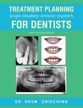 Paperback Treatment Planning Single Maxillary Anterior Implants for Dentists Book