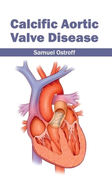 Hardcover Calcific Aortic Valve Disease Book