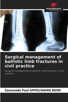Paperback Surgical management of ballistic limb fractures in civil practice Book