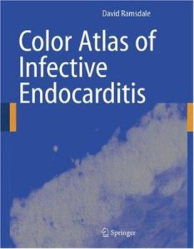 Paperback Color Atlas of Infective Endocarditis Book