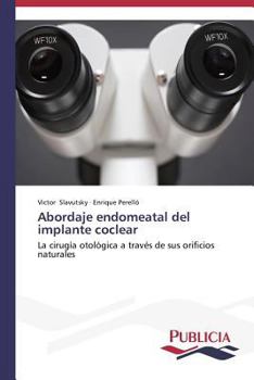 Paperback Abordaje endomeatal del implante coclear [Spanish] Book