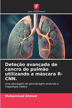 Deteção avançada de cancro do pulmão utilizando a máscara R-CNN. (Portuguese Edition)