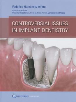 Hardcover Controversial Issues in Implant Dentistry Book