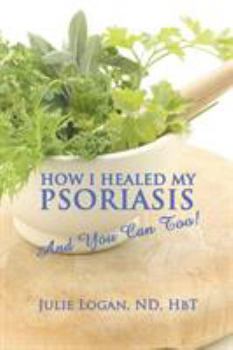 Paperback How I Healed My Psoriasis: And You Can Too! Book