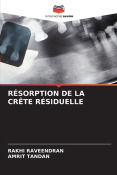Paperback Résorption de la Crête Résiduelle [French] Book
