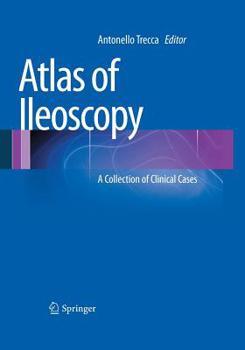 Paperback Atlas of Ileoscopy: A Collection of Clinical Cases Book