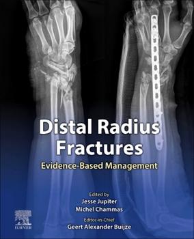 Hardcover Distal Radius Fractures: Evidence-Based Management Book