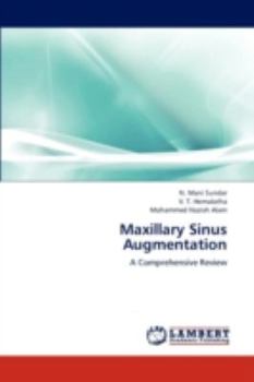 Paperback Maxillary Sinus Augmentation Book