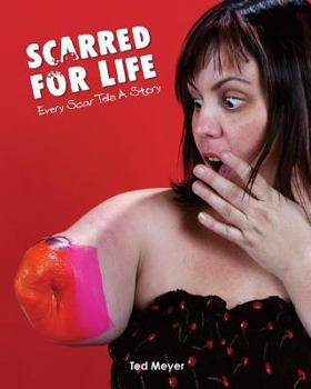 Paperback Scarred for Life: Every Scar Tells a Story Book