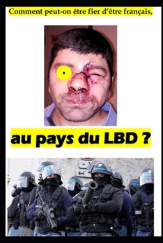 Comment peut-on ?tre fier d'?tre fran?ais, au pays du LBD ?
