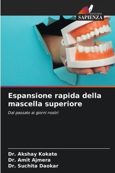 Espansione rapida della mascella superiore (Italian Edition)