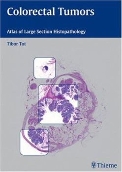 Hardcover Colorectal Tumors: Atlas of Large Section Histopathology Book