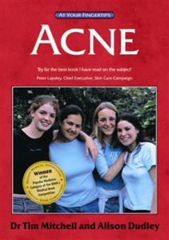 Paperback Acne: The 'At Your Fingertips' Guide Book