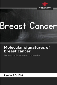 Paperback Molecular signatures of breast cancer Book