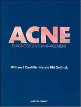 Paperback Acne: Diagnosis And Management Book