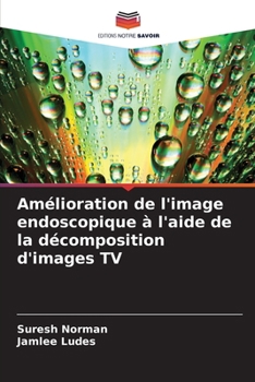 Amélioration de l'image endoscopique à l'aide de la décomposition d'images TV (French Edition)