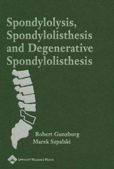 Hardcover Spondylosis, Spondylolisthesis, And Degenerative Spondylolisthesis Book
