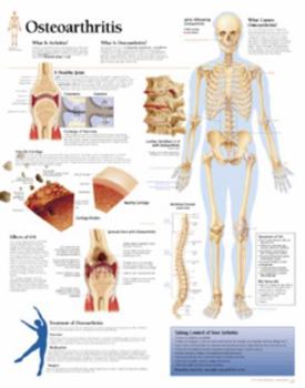 Understanding Osteoarthritis chart: Wall Chart