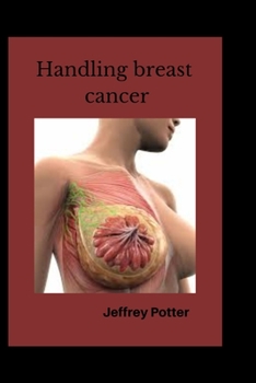 Paperback Handling breast cancer Book