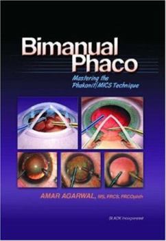 Hardcover Bimanual Phaco: Mastering the Phakonit/MICS Technique Book